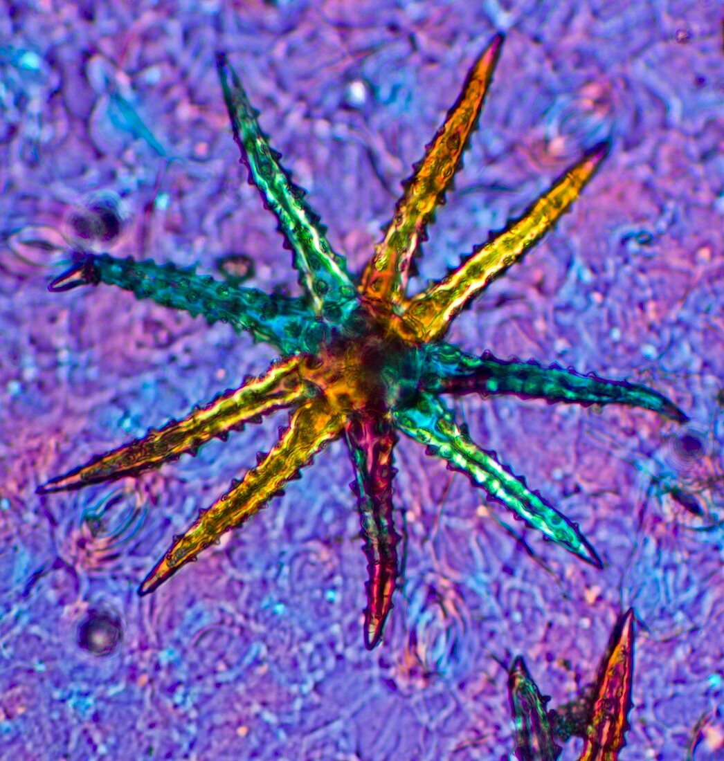 Stellate plant hair,light micrograph