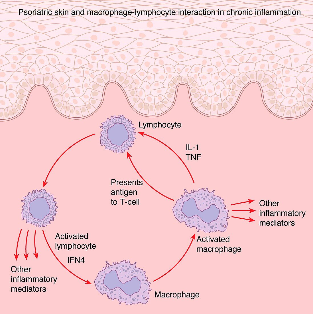 Immune response to chronic inflammation