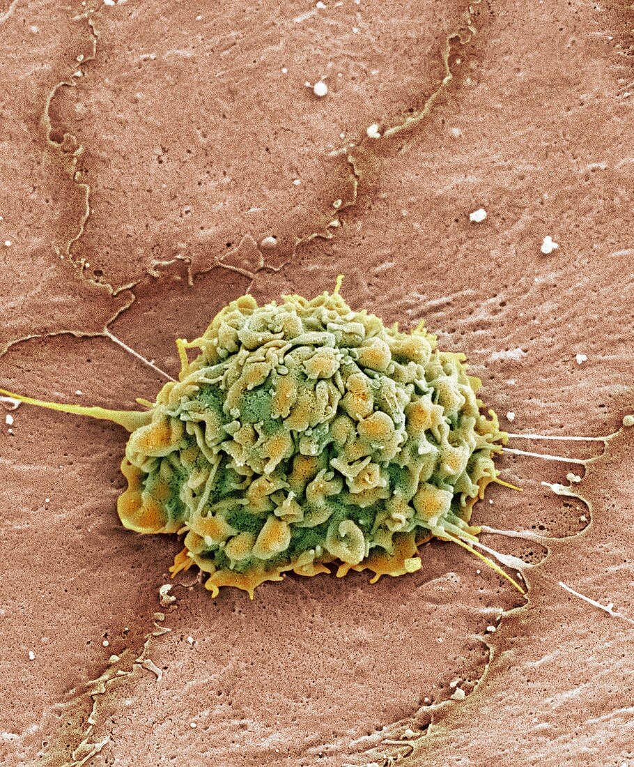 Liver macrophage cell,SEM