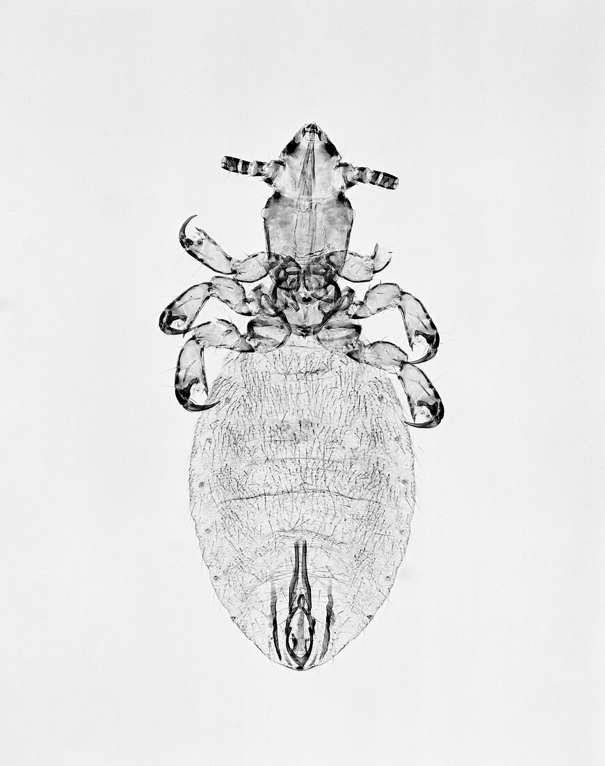 Camel sucking louse,light micrograph