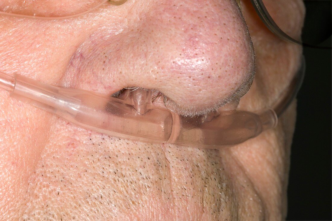 Oxygen fed to nose of COPD patient
