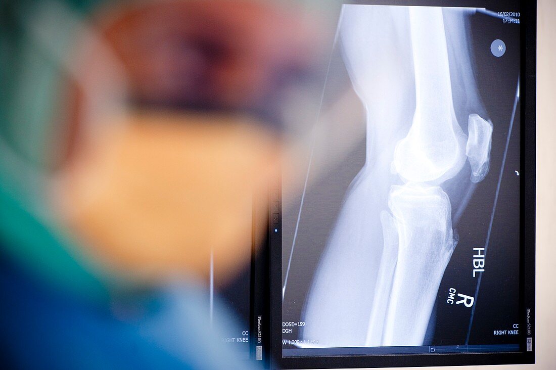Knee X-ray consultation