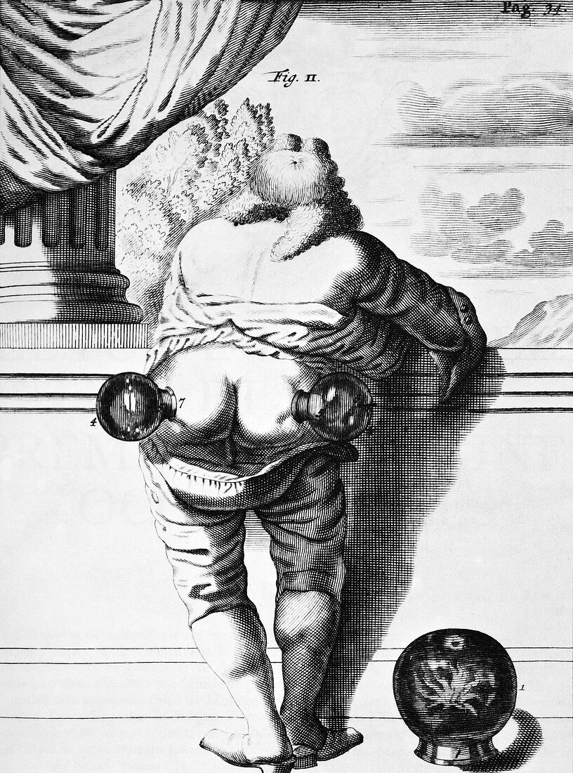 Cupping,historical artwork