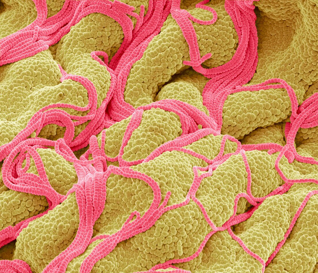 Evening primrose pollen,SEM