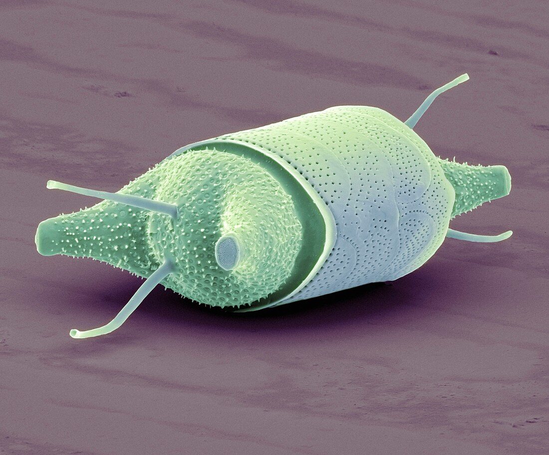 Diatom,SEM