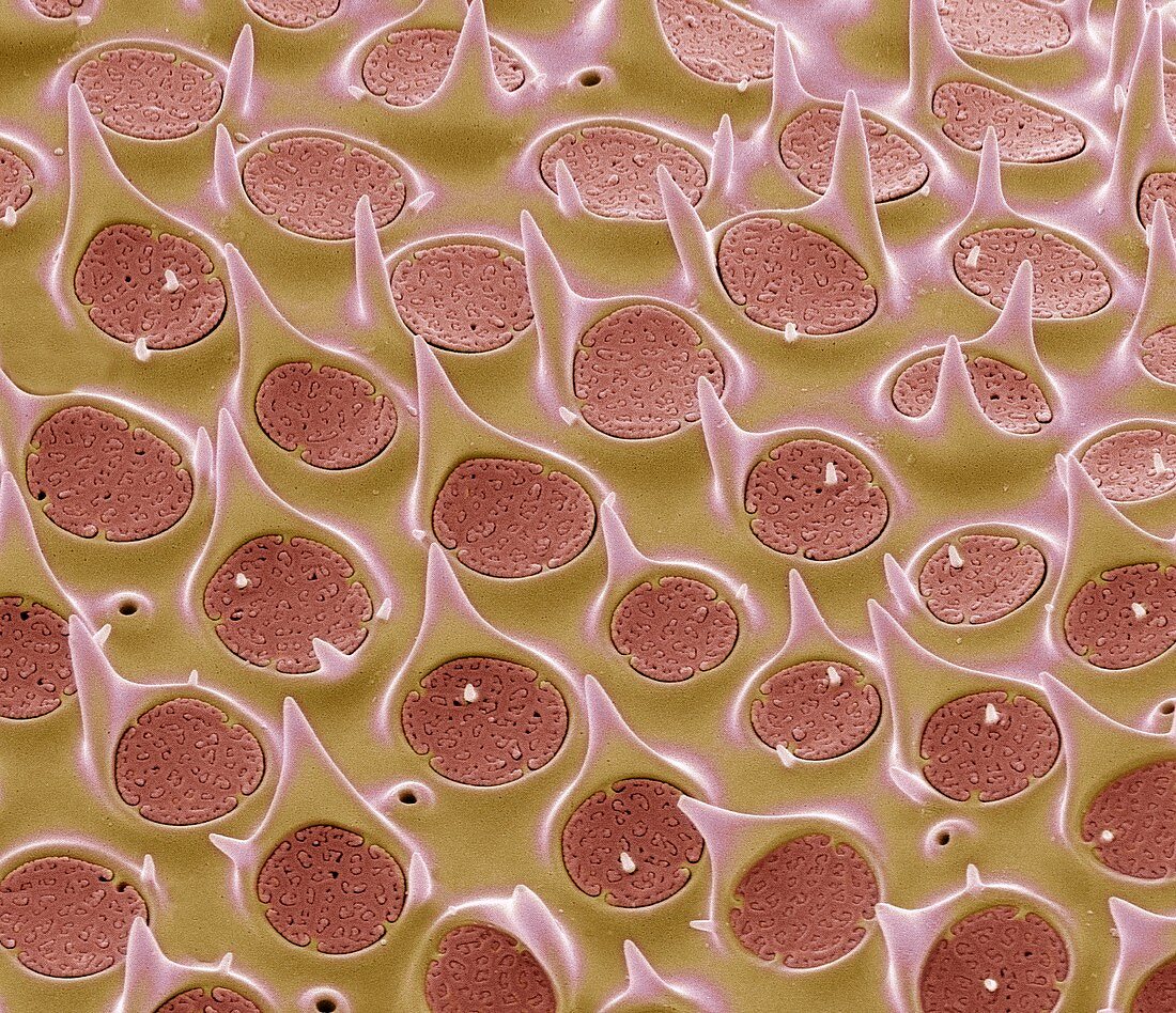 Diatom shell,SEM