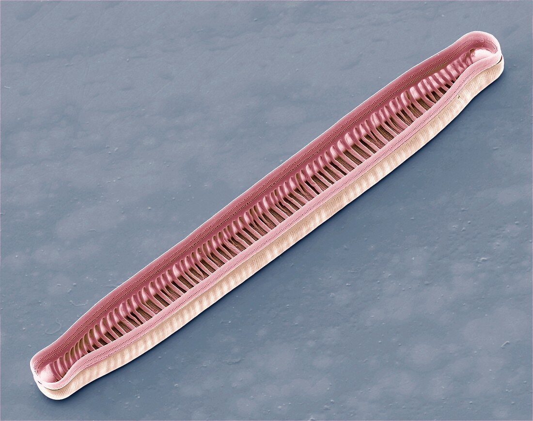 Diatom,SEM