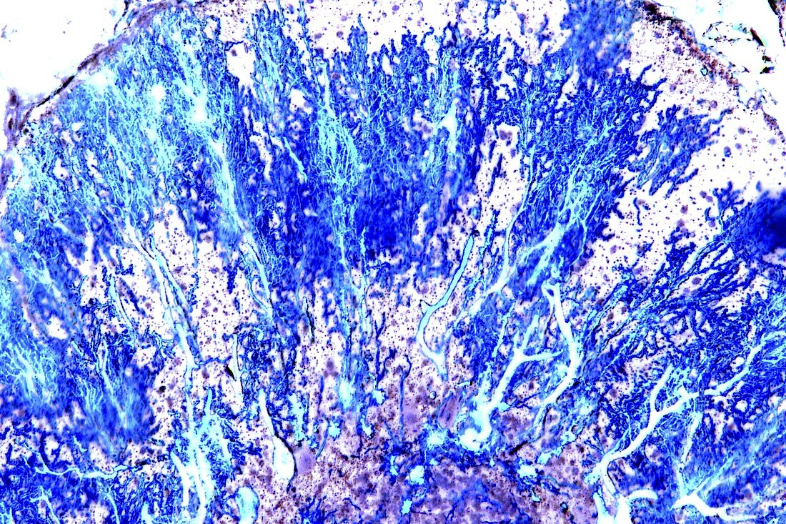 Purkinje nerve cells,light micrograph