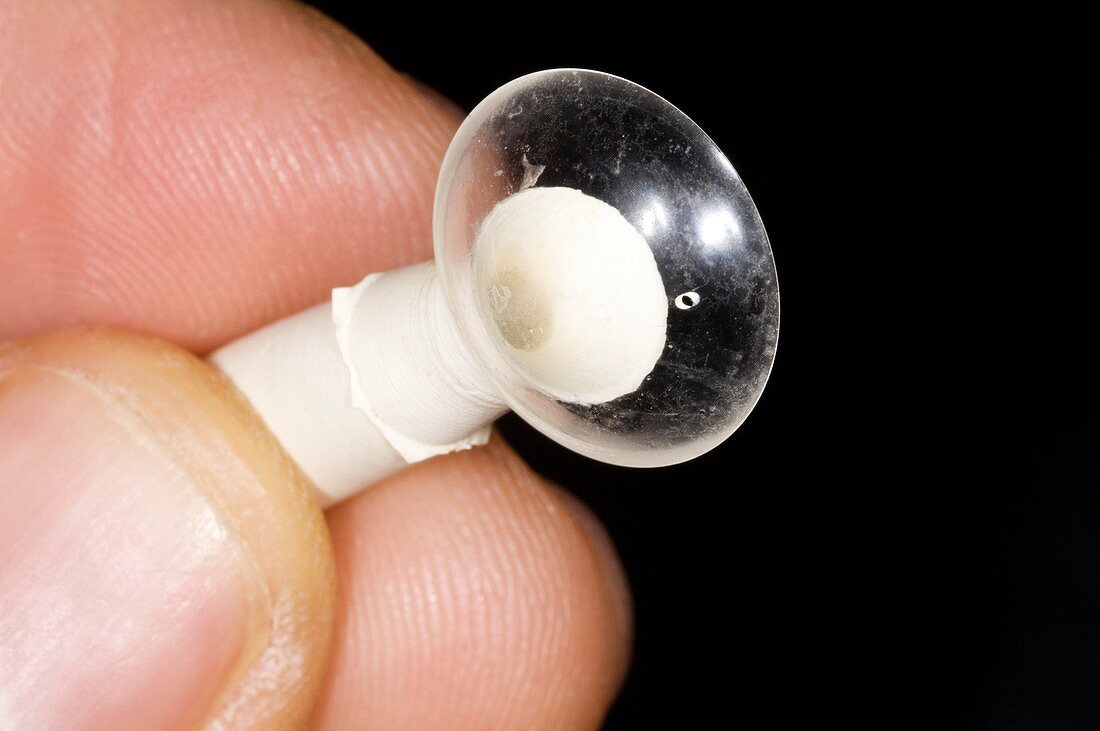 Hard contact lens for keratoconus