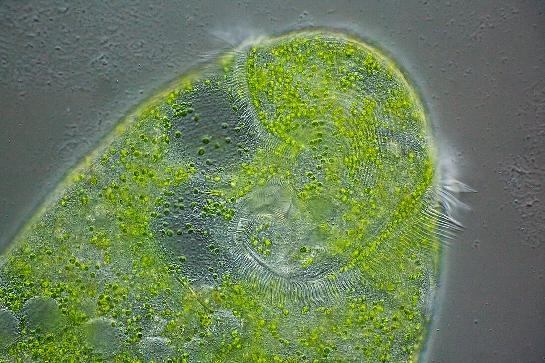 Stentor ciliate protozoan,micrograph