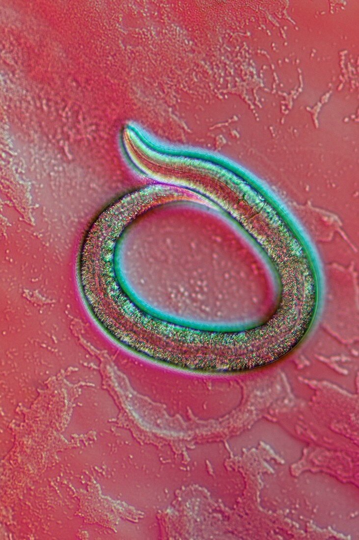 C. elegans mutant worm,light micrograph