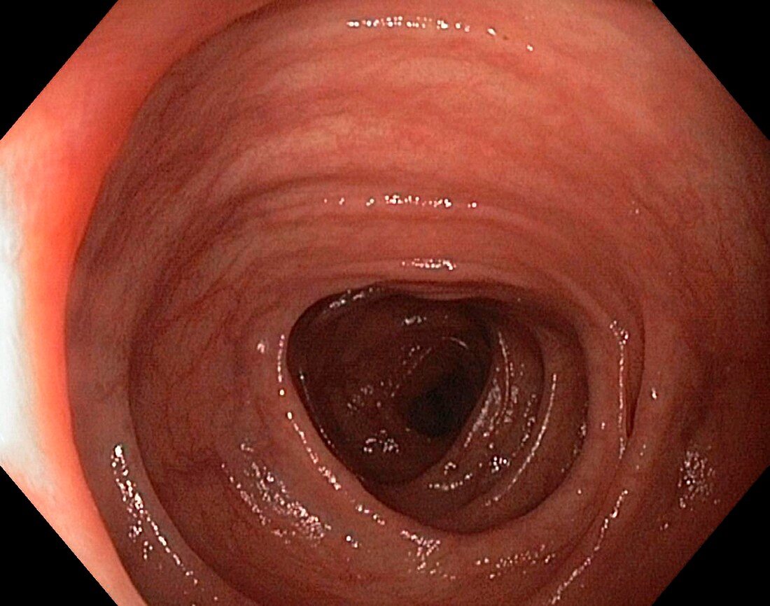 Healthy colon (large intestine)