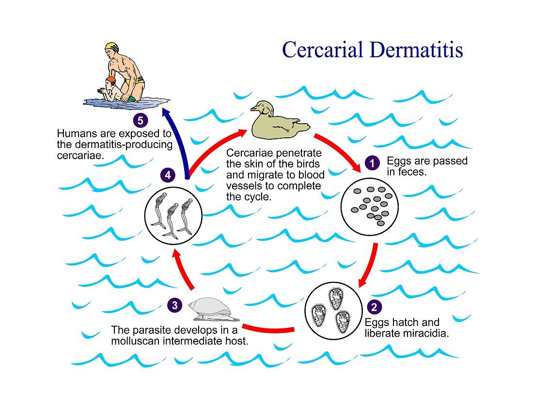 Cercarial dermatitis parasite life cycle