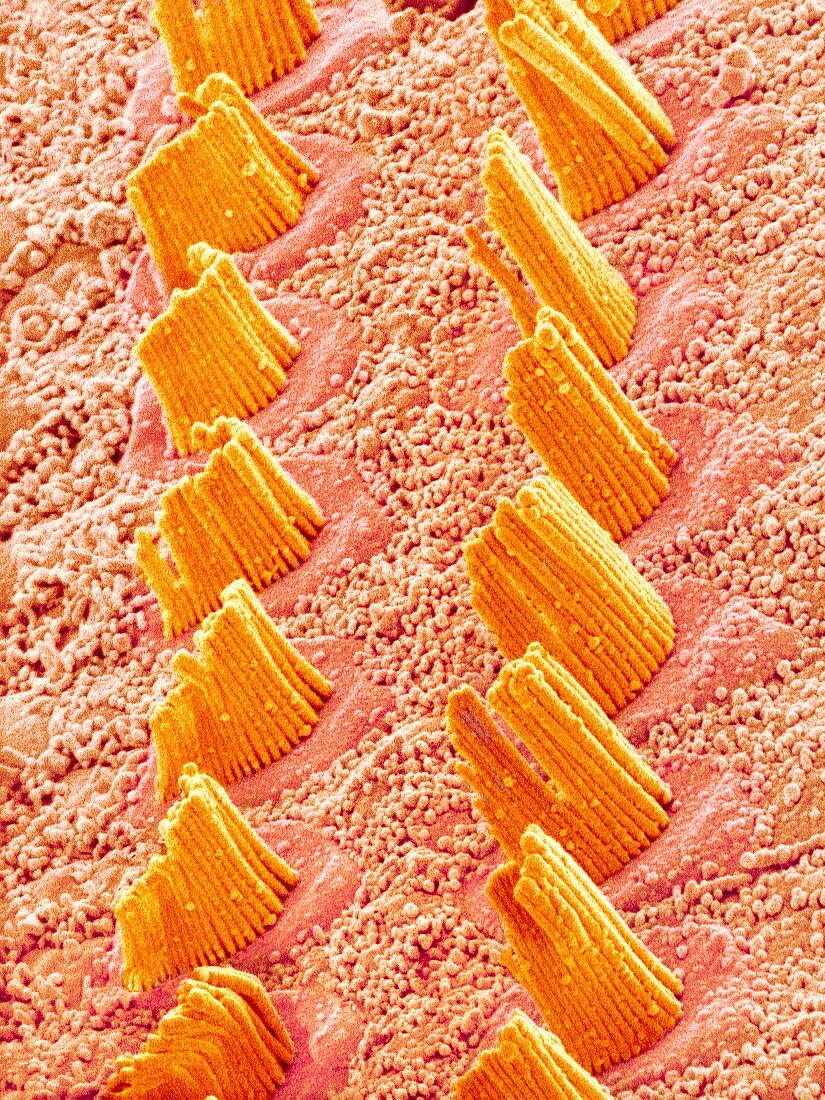 Inner ear hair cells,SEM