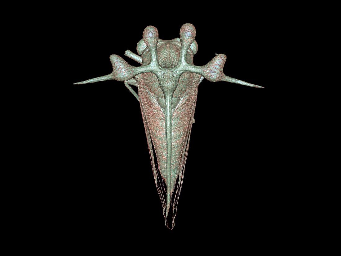 Leafhopper,3D reconstruction