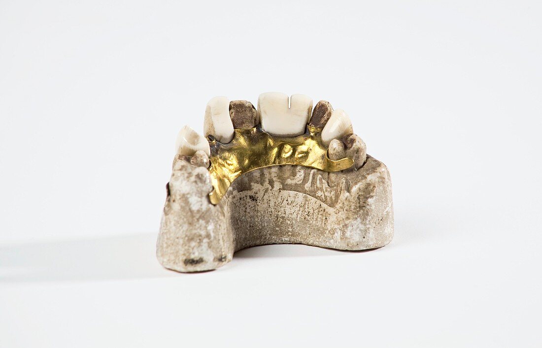 Gold denture with ivory teeth,1807