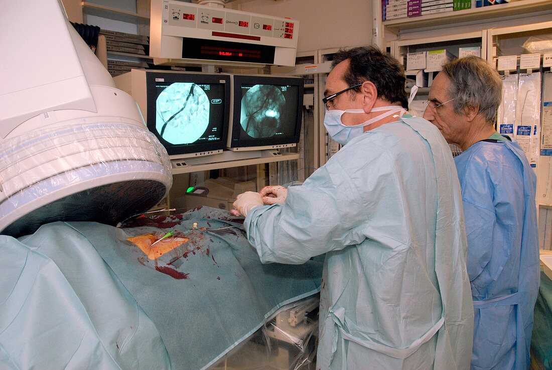 Balloon angioplasty surgery