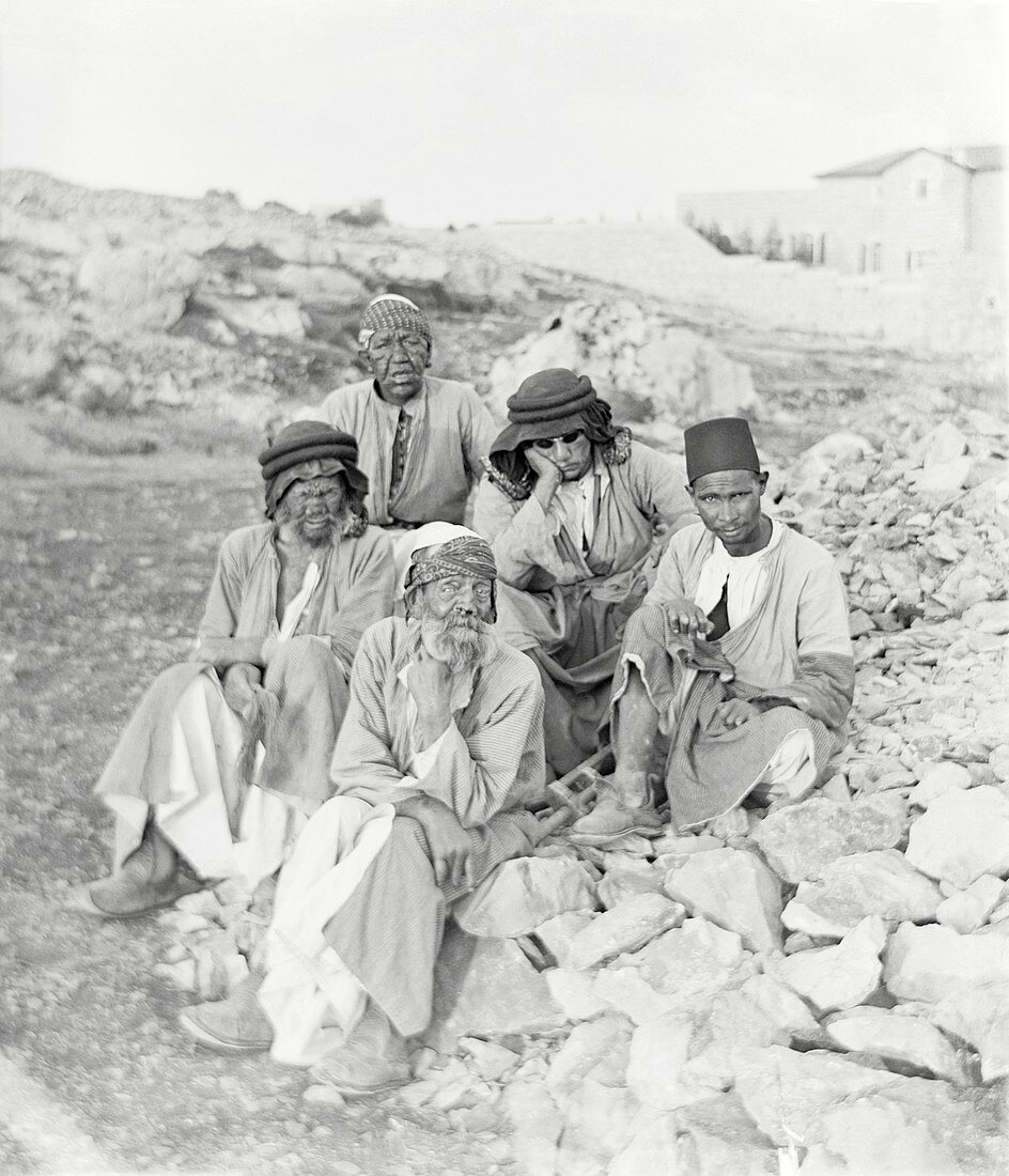 Lepers,Middle East,early 20th century