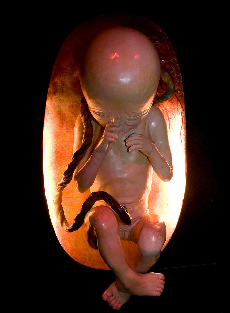 Human foetus,museum display