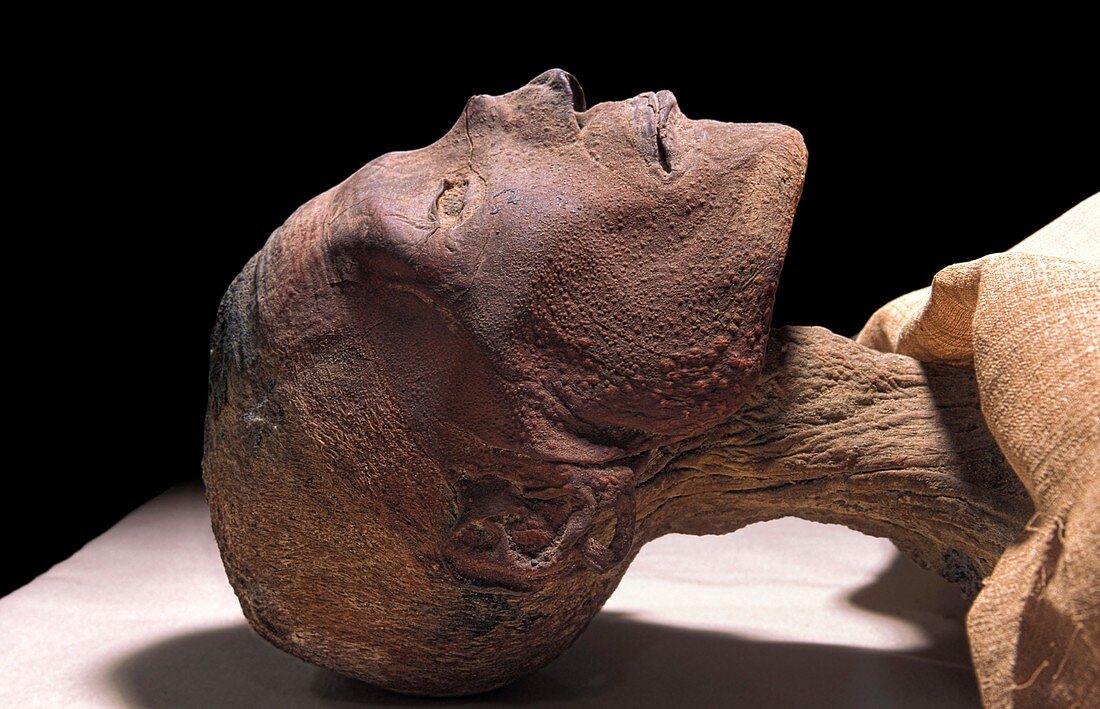 Ramases V mummy,Egypt