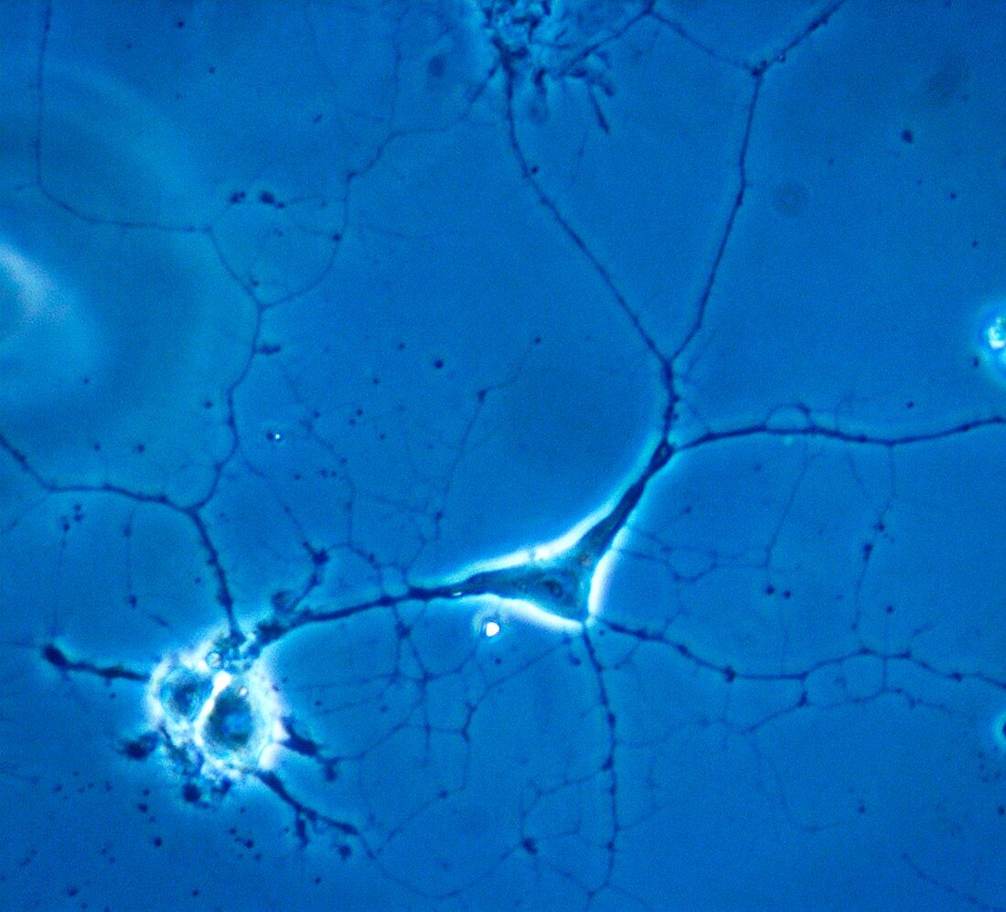 Brain cells,light micrograph