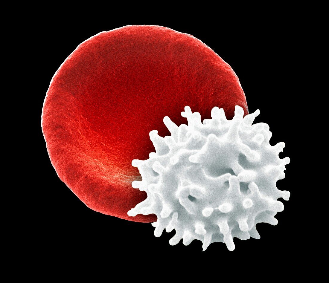 Healthy and crenated red blood cells,SEM