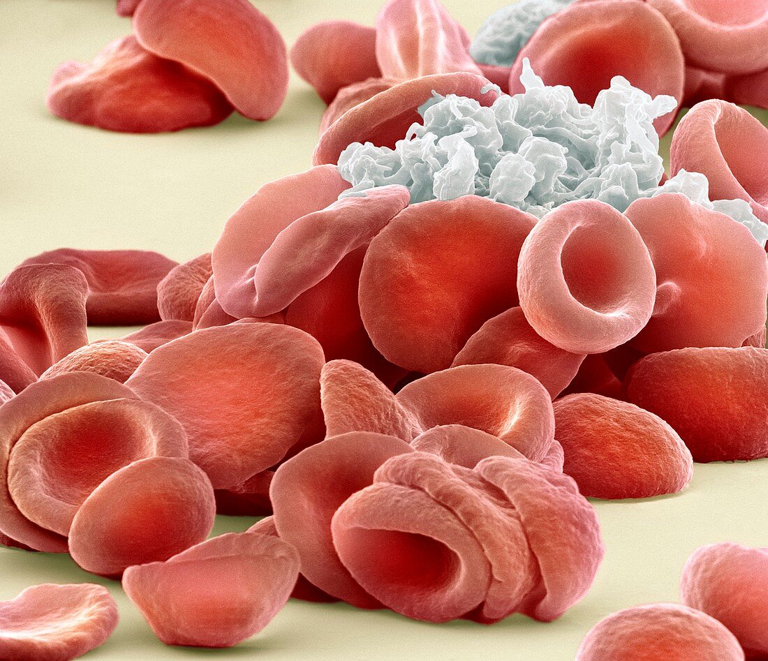 Blood clotting,SEM