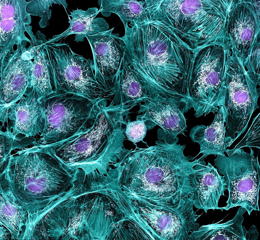 Lung cells,fluorescent micrograph