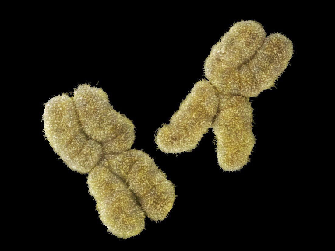 Human Chromosomes pair No. 1,SEM