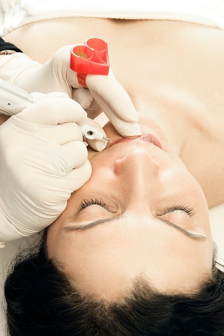 Micropigmentation cosmetic procedure