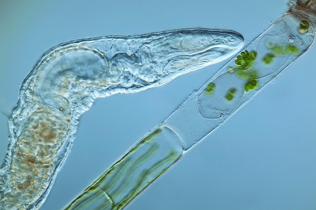Worm feeding on algae,light micrograph