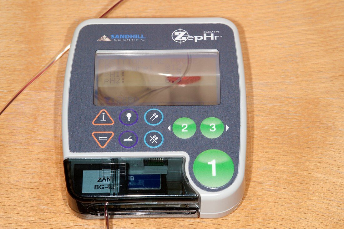 Oesophageal manometry and pH testing