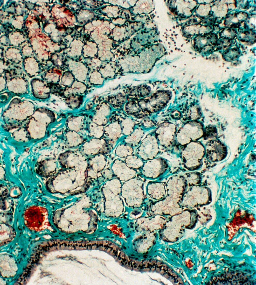 Salivary gland tissue,light micrograph