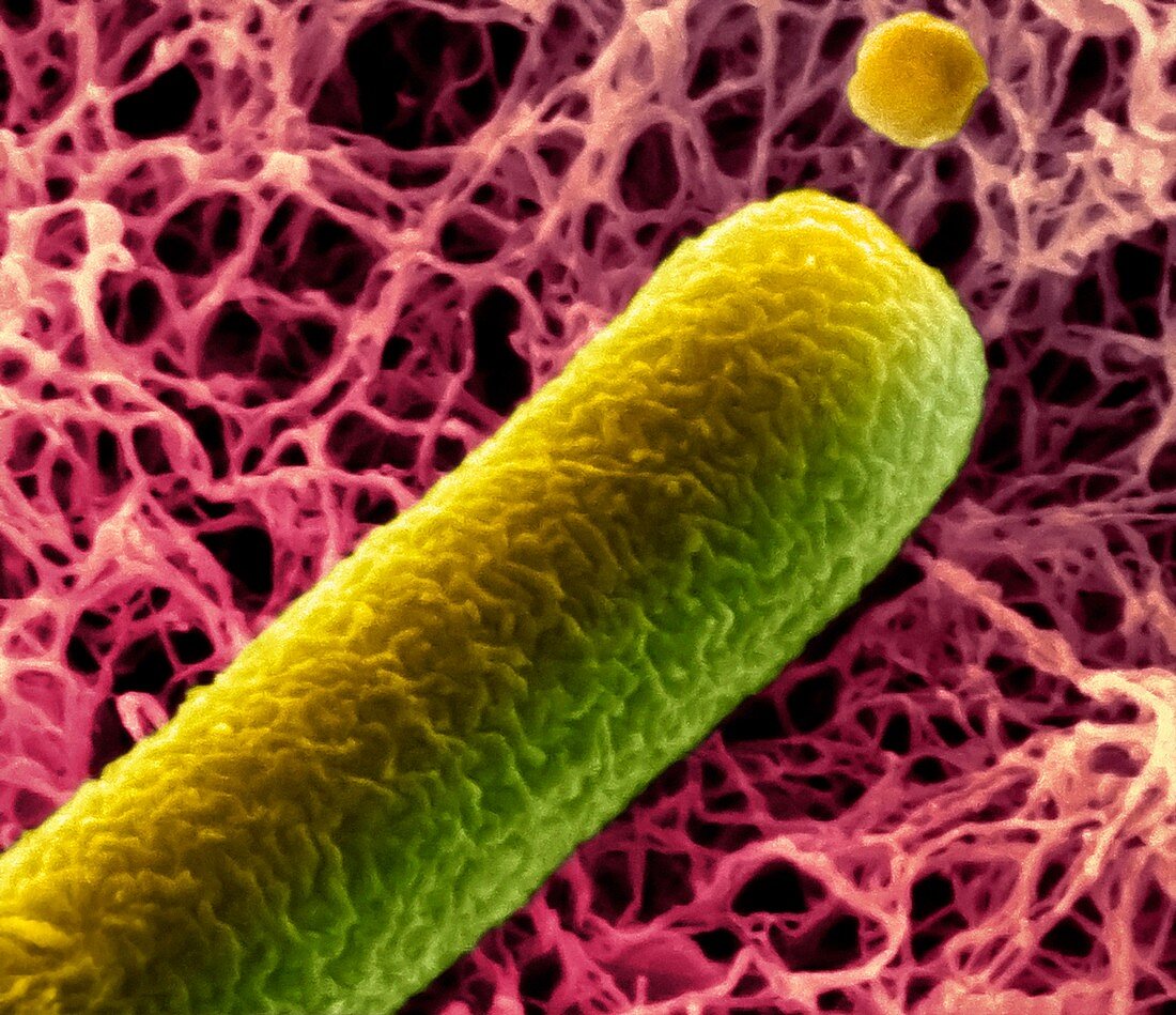 Clostridium difficile bacteria,SEM