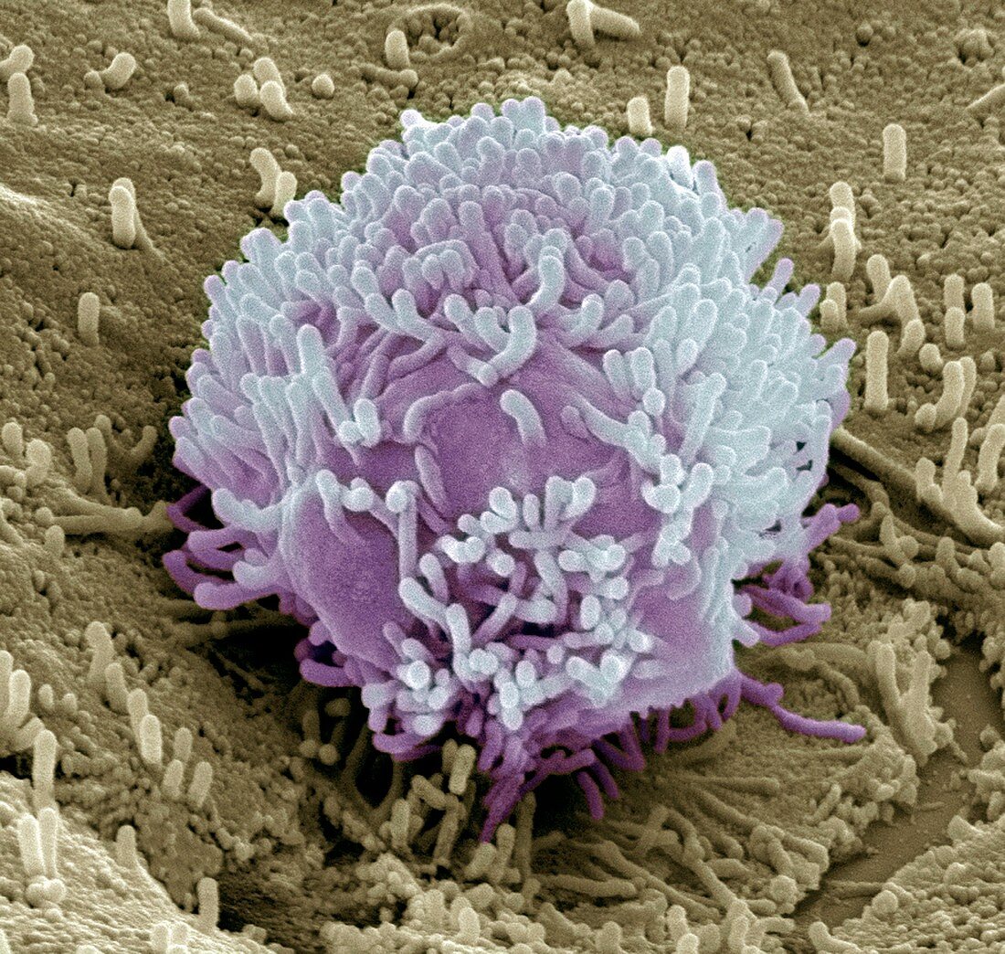 Colorectal cancer cell