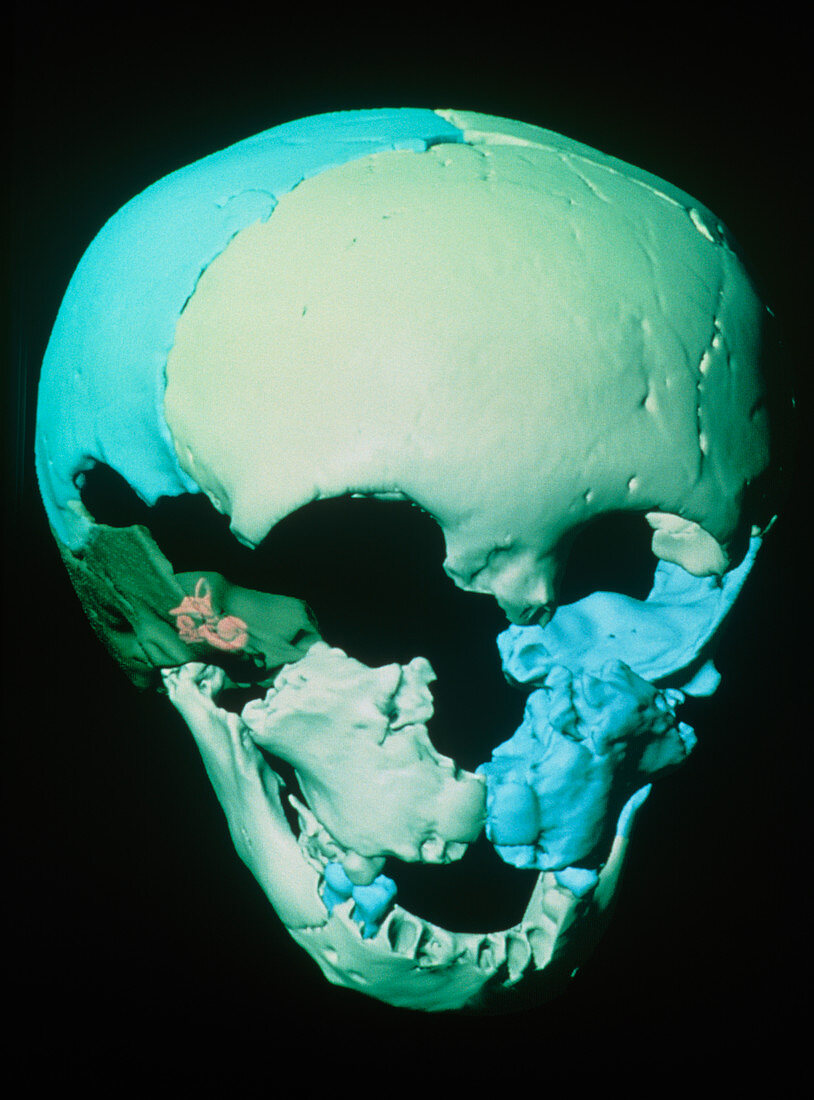 Computer reconstruction of Neanderthal child skull