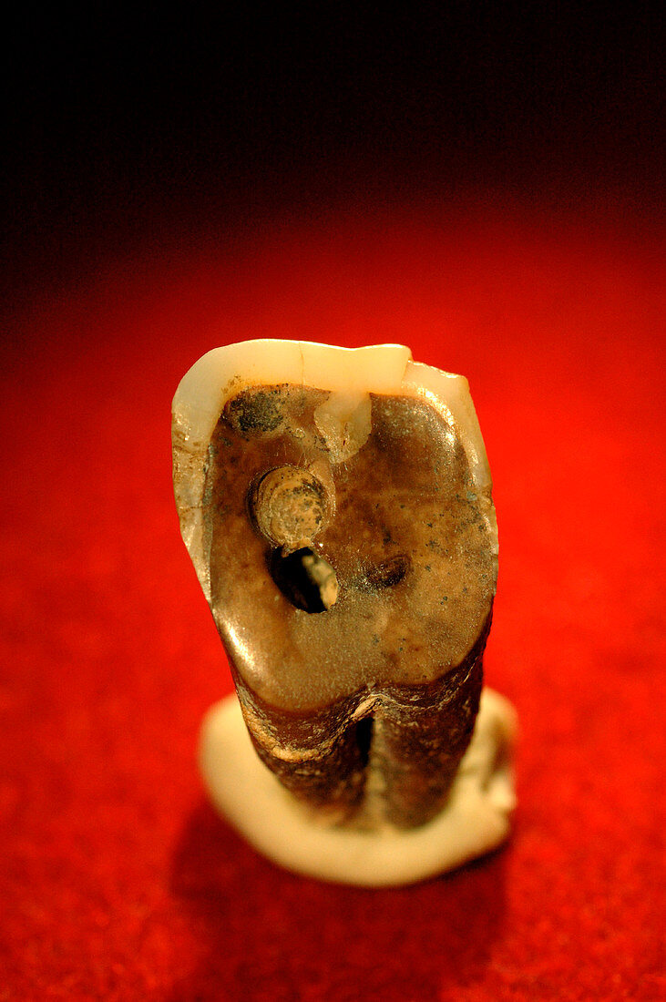 Neolithic tooth