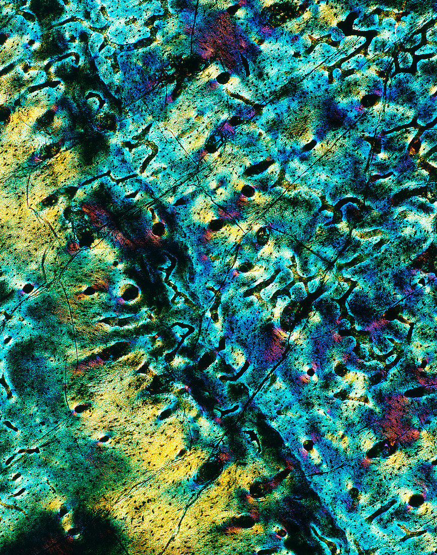 Fossil fish bone,light micrograph