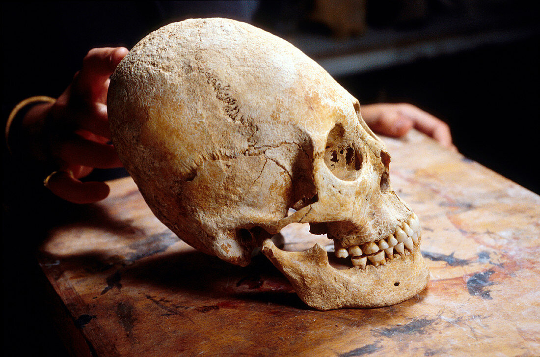 Artificially deformed Ostrogoth skull