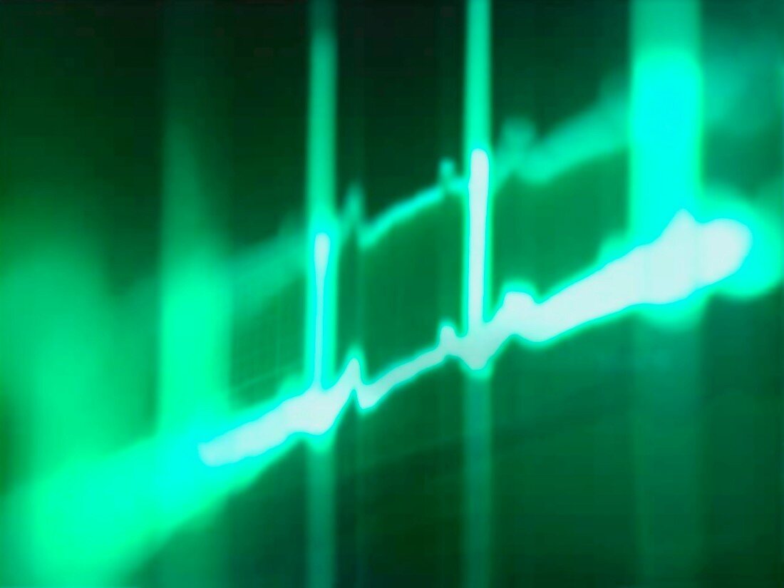 ECG,computer artwork