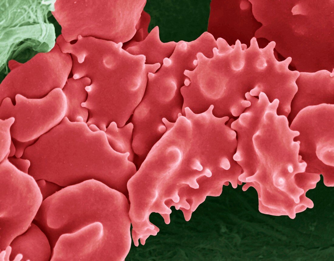 Crenated red blood cells,SEM