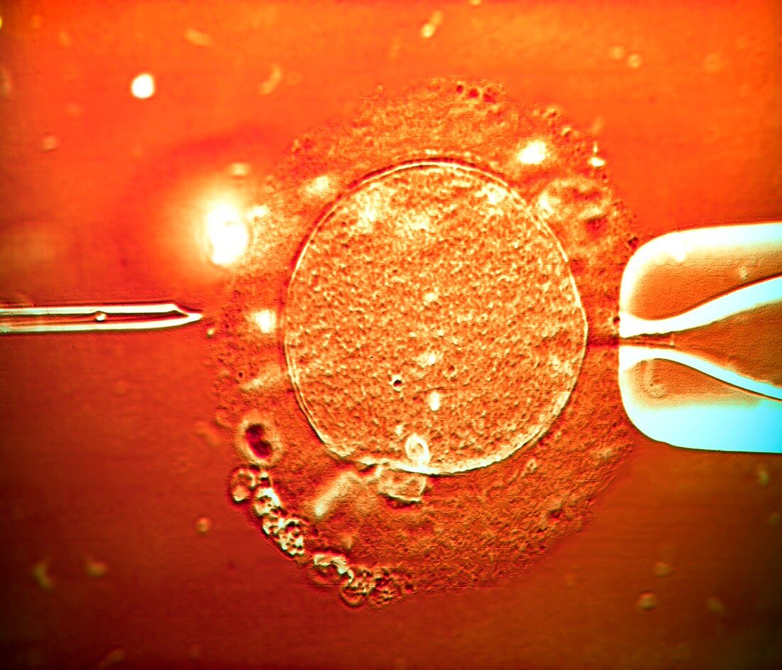 IVF treatment,light micrograph