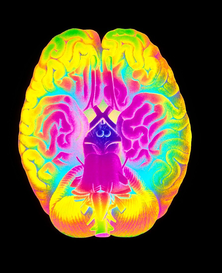 Mascagni artwork of human brain