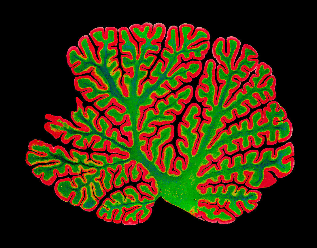Cerebellum structure,light micrograph