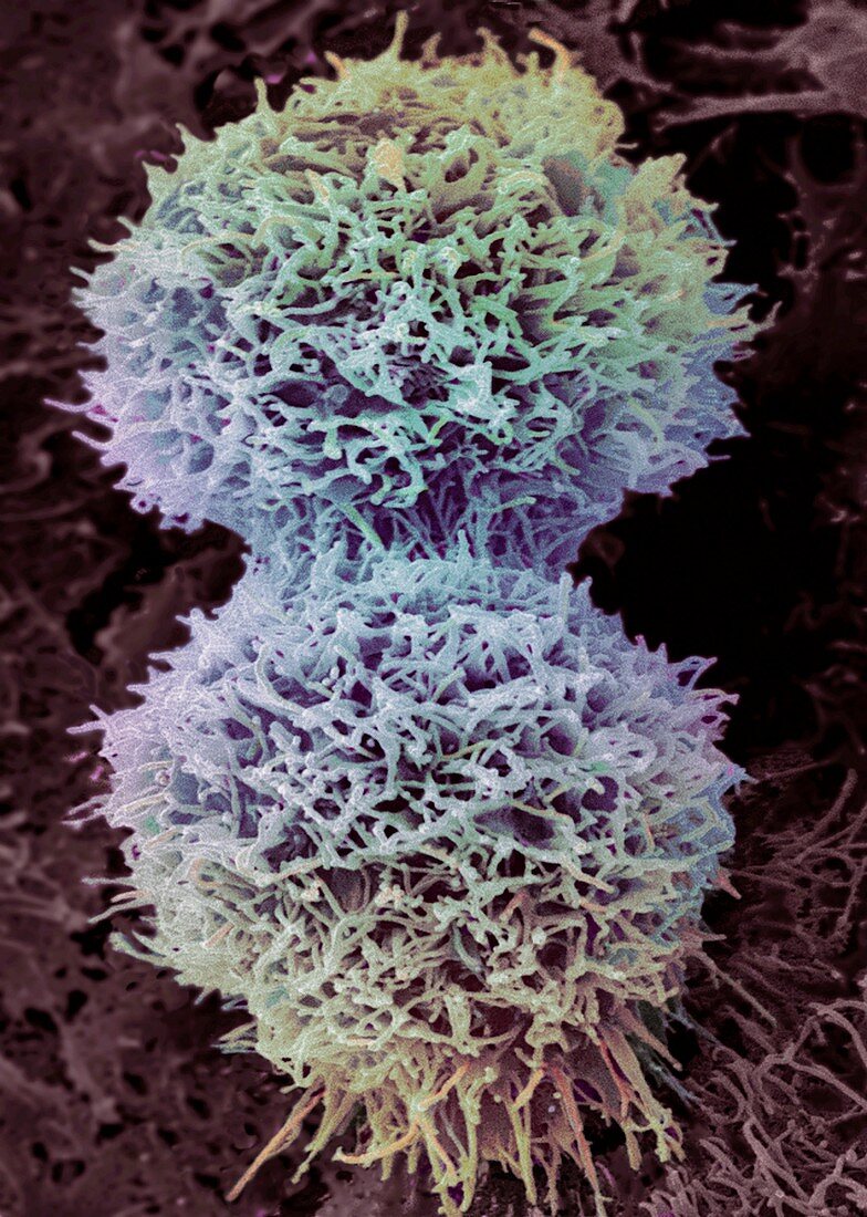 Dividing cervical cancer cell,SEM