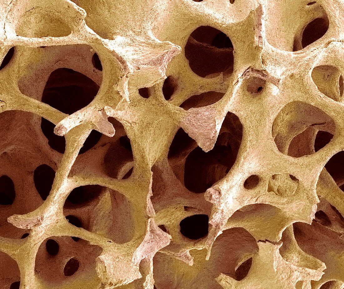 Bone tissue,SEM