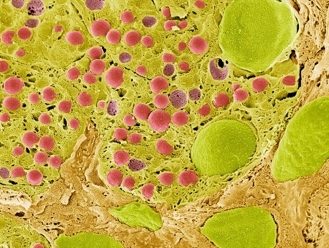 Pancreas tissue,SEM