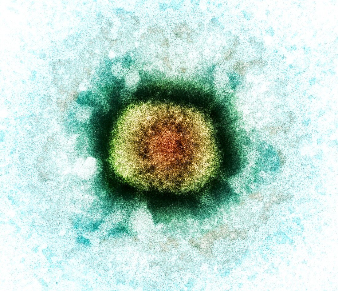 Vaccinia virus particle,TEM