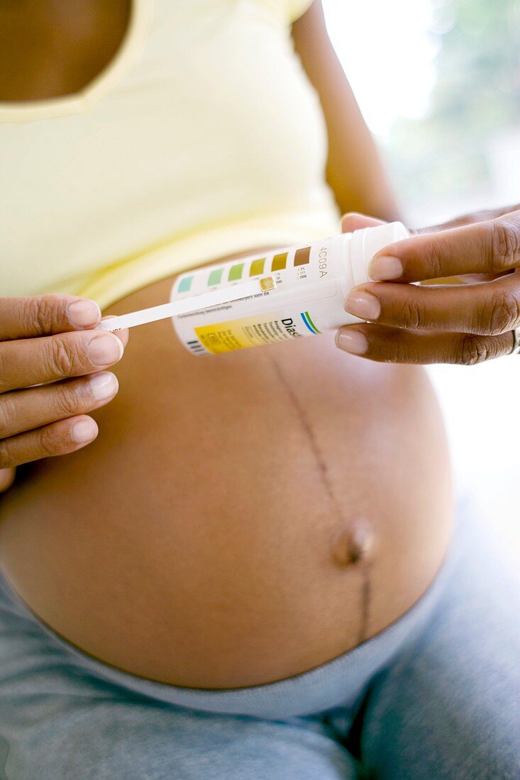Glucose test during pregnancy