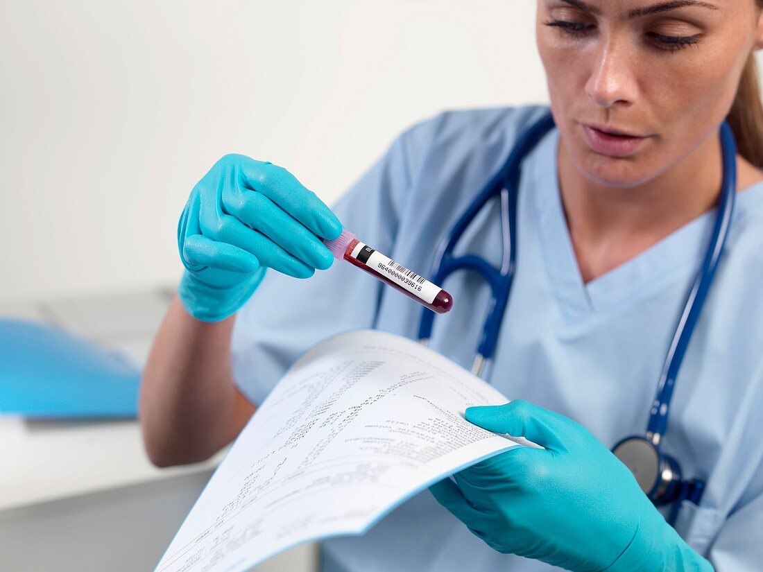 Doctor checking a blood sample